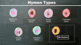 hymen-types-and-shapes-979617810.png