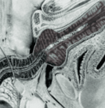 xray baculum inside pussy HOT.PNG