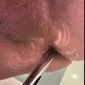 LoveMyProstate